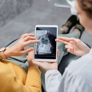 چرا کاشت ایمپلنت برای بیماران دیابتی حساسیت بیشتری دارد؟