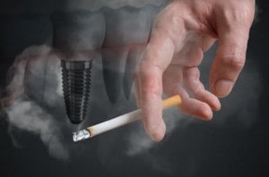 سیگار کشیدن به دنبال ایمپلنت جدید
