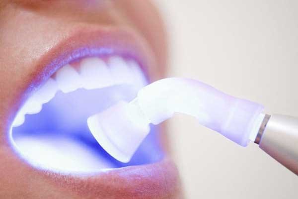 1 - انواع لیزر در دندانپزشکی و کاربرد آن ها