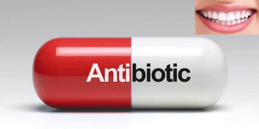 4 - درمان بیماری لثه با آنتی بیوتیک ها