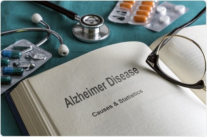 4 1 - عدم درمان عفونت لثه دلیلی بر پیشرفت آلزایمر