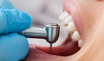 دندانپزشکی ترمیمی 