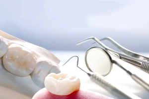 آماده سازی برای چسباندن روکش دائمی