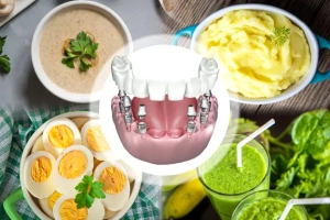 نکات تغذیه ای بعد از کاشت ایمپلنت دندان