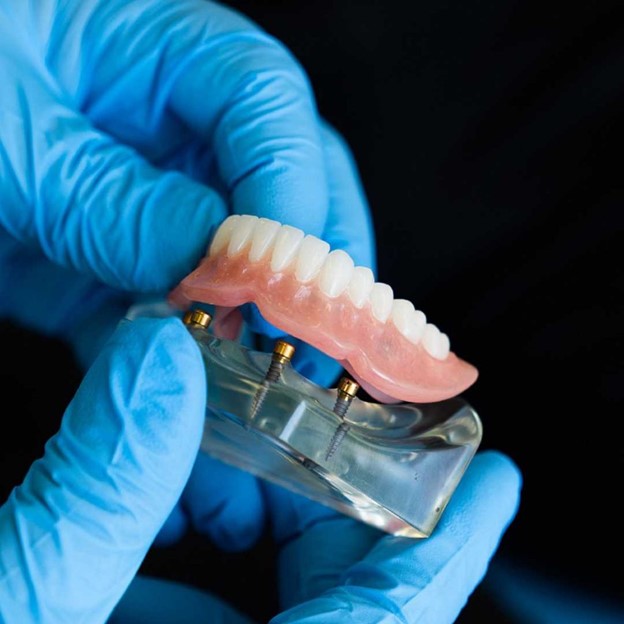 23 - بهترین دهانشویه برای ایمپلنت های دندانی توصیه شده توسط دندانپزشکان