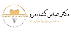 دکتر عباس گشاده رو متخصص ایمپلنت تهران