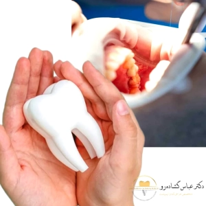 عوارض دندان عقل نهفته