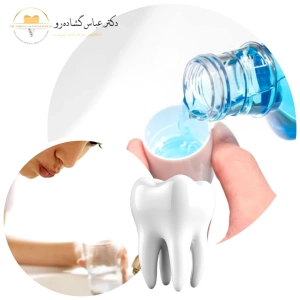 دندان عقل نهفته چگونه درمان می شود؟