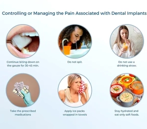 بهترین استراتژی ها برای مدیریت درد بعد از کاشت ایمپلنت دندان