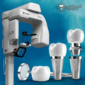 تصویربرداری دیجیتال سه‌بعدی CBCT