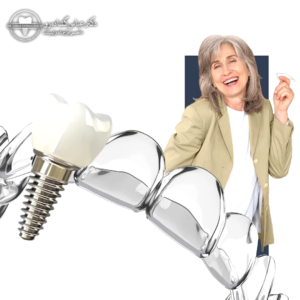 چه کسانی بهترین کاندیدای ایمپلنت هستند؟