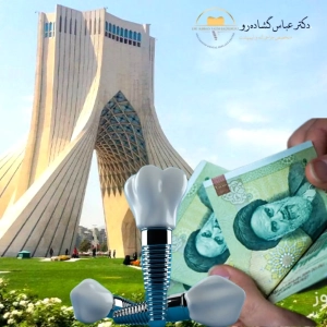 چرا نمی‌توان یک عدد مشخص برای قیمت ایمپلنت دندان در تهران اعلام کرد؟