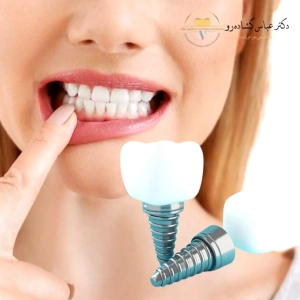 عامل دوم: سلامت لثه‌ها و بافت نرم اطراف