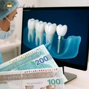 مزایای ایمپلنت دیجیتال؛ آیا هزینه‌ی بیشترش منطقی است؟