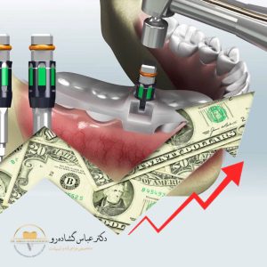 چرا ایمپلنت دیجیتال ارزش سرمایهگذاری دارد؟