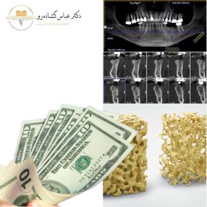 وقت آن رسیده که گام اول را بردارید