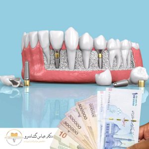 چرا قیمت پایین همیشه به نفع شما نیست؟