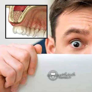 چرا تجربه جراح در لیفت سینوس تا این حد حیاتی است؟ 🤔