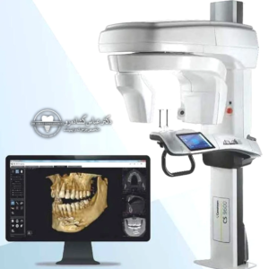 1) یک بررسی سریع و شفاف با CBCT