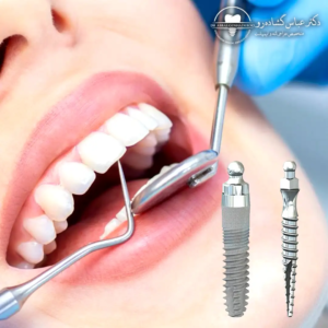 مهندسی سوئیسی؛ چرا این سه کلمه برای بیماران من اهمیت دارد؟